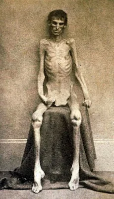 AndersonvillePrisoner