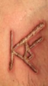 While it sounds extremely cruel to brand someone without anesthesia, it is in fact how all branding is done – since people who brand – and there are hundreds in the USA – normally are not legally able to administer anesthesia. As stupid as branding [or tattooing] may be to some people, branding and tattoo artists can do their marking of customers' bodies without any qualifications and obviously without anesthesia.