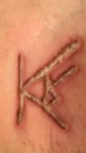 While it sounds extremely cruel to brand someone without anesthesia, it is in fact how all branding is done – since people who brand – and there are hundreds in the USA – normally are not legally able to administer anesthesia. As stupid as branding [or tattooing] may be to some people, branding and tattoo artists can do their marking of customers' bodies without any qualifications and obviously without anesthesia.