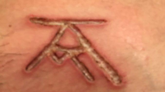How hard is it to get rid of a branding scar? – Some DOS slaves want to know