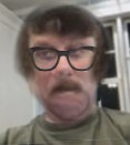 dr cloephus robson anon
