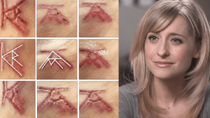 Pictures of a DOS slave’s brand, outlining the initials of Keith Raniere and Allison Mack. Mack, pictured right.