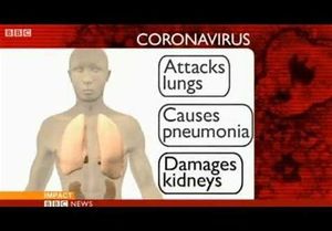 Coronavirus-Related Problems