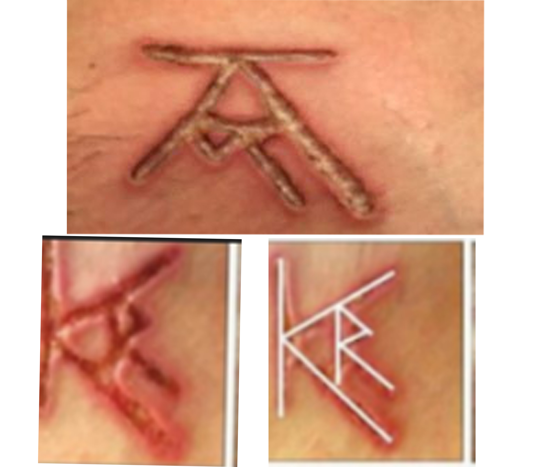 Guest View: Dr. Roberts Wrong to Brand Women Without Disclosing Raniere Initials – Medical Board Right