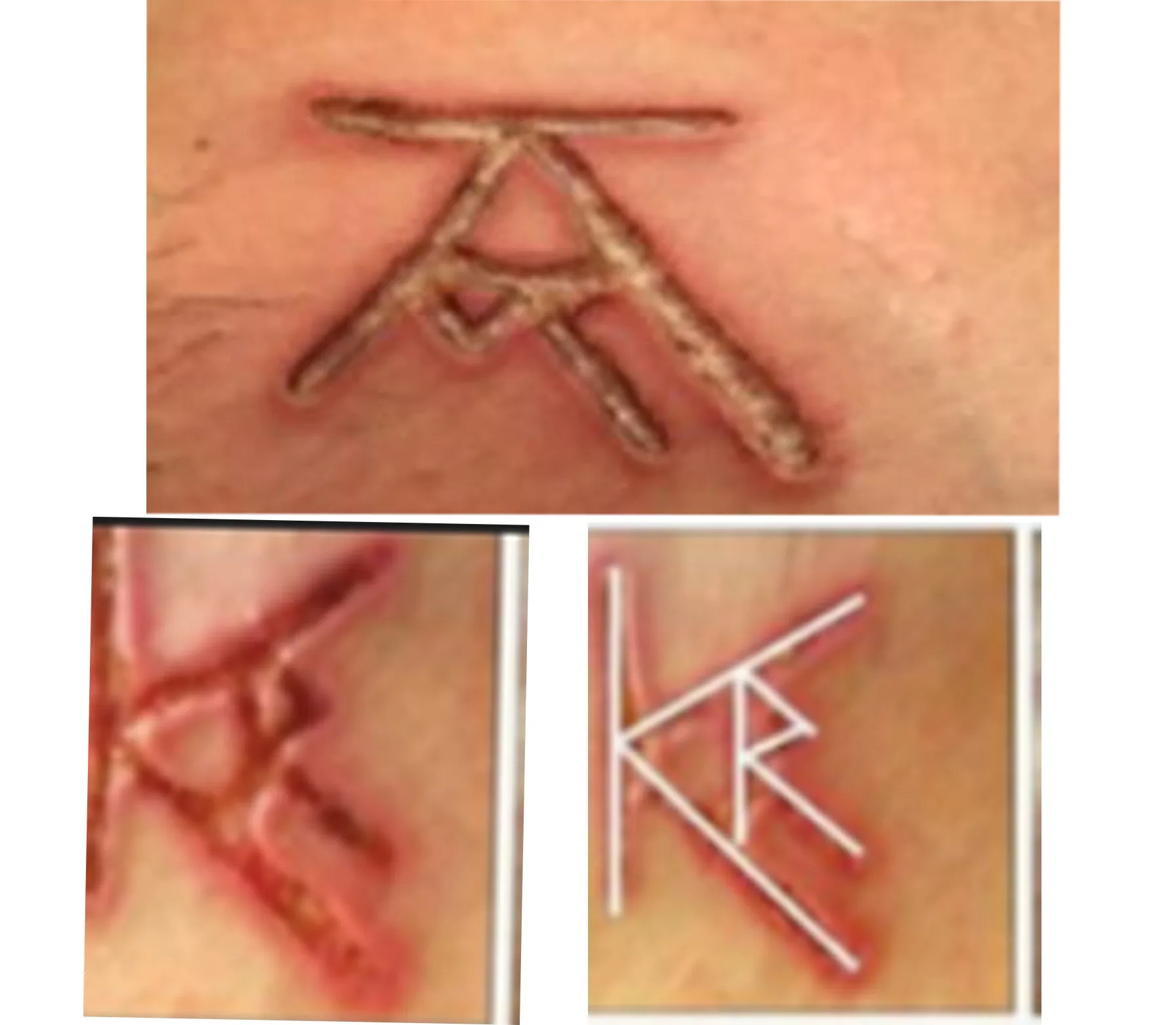 Guest View: Dr. Roberts Wrong to Brand Women Without Disclosing Raniere Initials – Medical Board Right