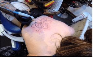 Roberts gave Edmondson a brand using an electrocautery pen, similar to what is used to give tattoos.
