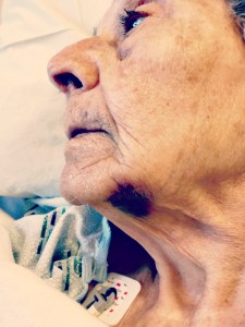 Bertha after her stroke.