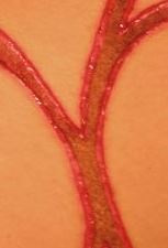 Slow-healing DOS brands reveal Raniere’s initials getting wider, more elevated on pubic region