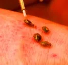 bed bugs 784
