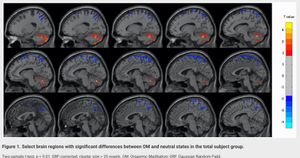OM brain study