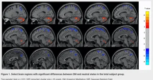 OM brain study