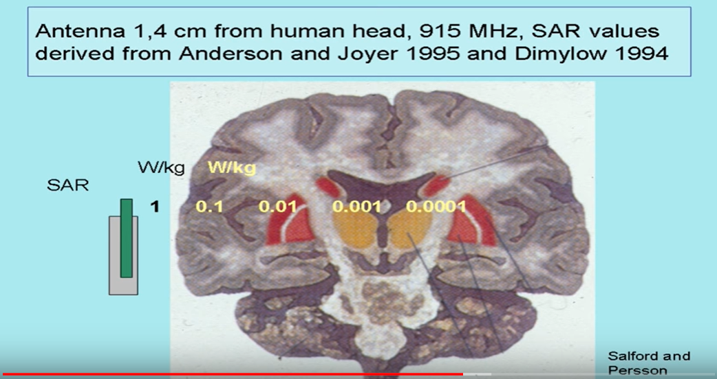 Every Time You Hold the Cell Phone to Your Head, This May Be the Time That You Initiate a Brain Tumor