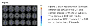 Brain OM